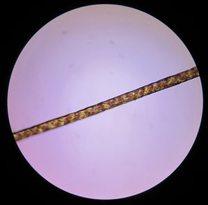 Alternating light and dark bands (“tiger tail” pattern) on polarized light microscopy.