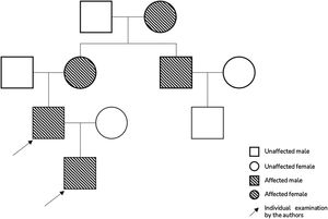 Pedigree of dentinogenesis imperfecta in the family of the patient based on medical records, spanning 4 generations.