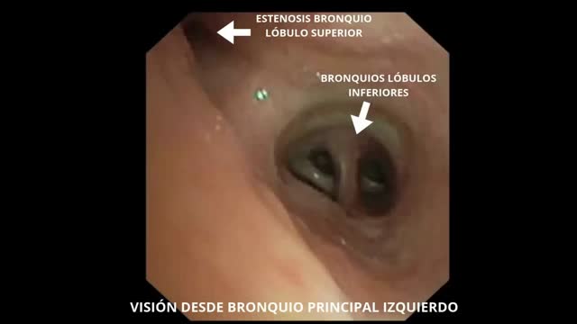 https://ars.els-cdn.com/content/image/1-s2.0-S2341287926002759-mmc1.mp4