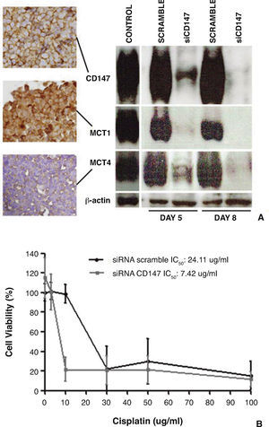 Effect of CD147 downregulation in HT1375 cell line on the expression of MCTs and on chemosensitivity to cisplatin (treatment with cisplatin between days 5 and 8 after reverse transfection). A, CD147, MCT1 and MCT4 immunoexpressions in HT1376 control cells, and Western blot analysis of CD147, MCT1 and MCT4 expressions in control/scramble HT1376 cells and in siCD147 HT1376 cells, showing that CD147 silencing was accompanied by a decrease in MCT1 and MCT4 expressions. B, effect of cisplatin on the viability of scramble and siCD147HT1376 cells, as detected by the MTS assay after 72 hours of treatment, showing that siCD147 cells were more sensitive to cisplatin (adapted from Afonso et al.71).