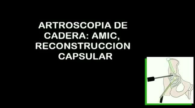 https://ars.els-cdn.com/content/image/1-s2.0-S2386312916000025-mmc1.mp4