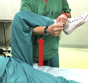 Test de distracción foveal, aplicando una tracción de la cadera con la rodilla flexionada se reproduce la maniobra FAI y DIRI. Si se reduce el dolor en distracción se considera positiva y claramente indicativa de lesión articular.