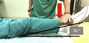 Test de Stinchfield, con extensión de la extremidad de forma completa a una altura de 30° contra la resistencia del explorador, generando de forma positiva dolor en la articulación de la cadera.