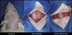 Initial surgery procedure.