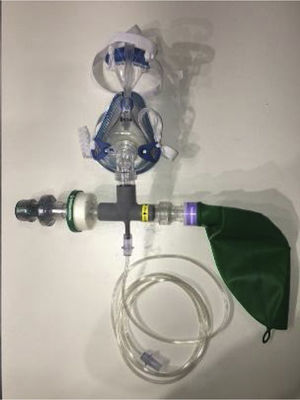 Alternative CPAP model type A.