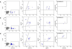 Analysis of naive B lymphocyte subpopulations in patient 12. Class switch, IgM memory B cell populations and plasmablasts before vaccination (A), after first dose (B) and second vaccination dose (C) Memory/switch B-lymphocytes were already present before vaccination and plasmablasts appeared only after vaccination.