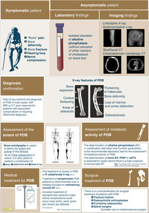Algorithm for the management of Paget’s disease of bone.