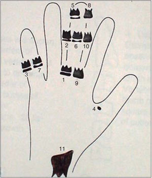 Indicadores de maduración ósea.