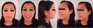 Fotografías faciales postratamiento.