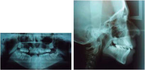 Radiografías panorámica y lateral de cráneo pretratamiento.