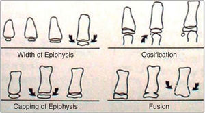 Ossiﬁcation stages.