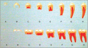 Dermirjian's procedure for the evaluation of dental age.