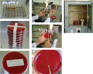 Planting in Blood Agar Gel and incubation for 24 hours. A) Brackets submerged in BHI, B) Blood Agar Gel, C) Labeling of the Petri dish, D) Flaming, E) Inoculation with cotton swab, F) Streak plate technique, G) Planting at 35 oC for 24 hours.