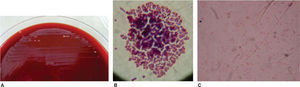 Microscope view (Olympus 100X). A) Colony growth, B) Cocci, C) Bacilli.