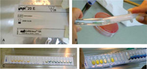 Biochemical test API 20E for bacilli identification. A) Identification system for Enterobacteriaceae, B) Bacilli sample take, C) Bacilli inoculation in API 20E, D) Shigella identification.