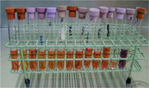 Biochemical tests for Staphylococcus identification.