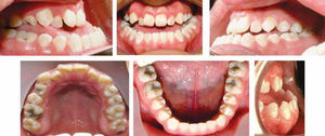 Intraoral photographs.