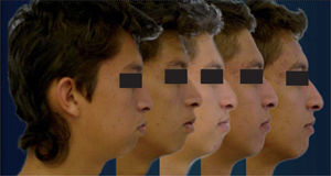 Evolución del caso.