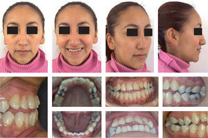 Facial and intraoral photographs.