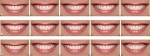 Modificaciones para cada parámetro, colocadas en orden aleatorio. A) Línea media. B) Margen gingival. C) Exposición gingival.