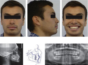 Fotografías extraorales.
