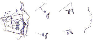 Radiografías finales.