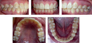 Fotografías extraorales finales.