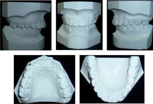 Modelos de estudio finales.