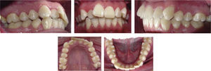 Initial intraoral photographs.