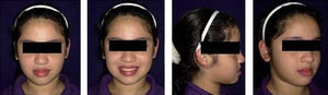 Facial photographs. Initial clinic evaluation.