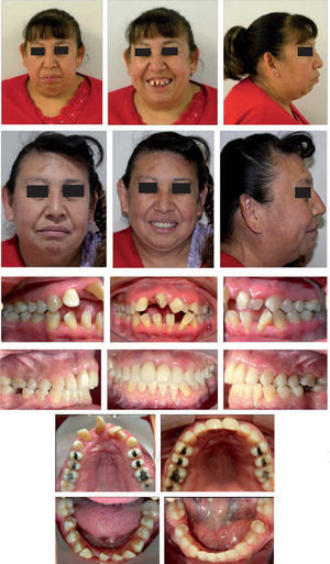 Fotografías comparativas inicial y final del tratamiento.