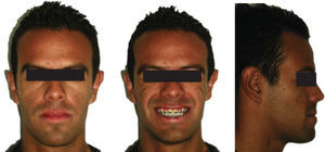 Facial assessment of treatment progress.
