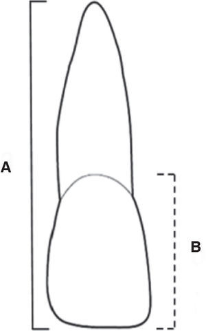 Measurements made on each tooth: A. Total length, and B. Crown length.