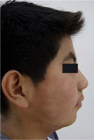 Foto de perfil del paciente después del tratamiento de ortopedia.