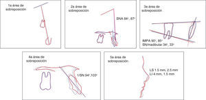 Áreas de sobreposición.