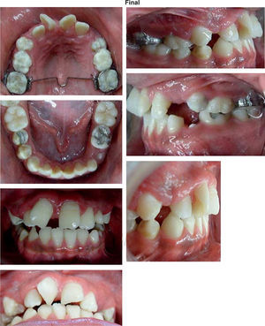 Fotografías finales después del tratamiento ortopédico.