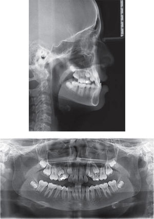 Radiografía cefálica lateral y panorámica inicial.
