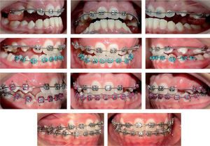 Treatment progress.