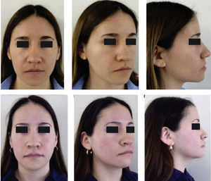 Initial and final facial photographs.