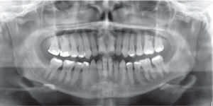 Initial panoramic radiograph.