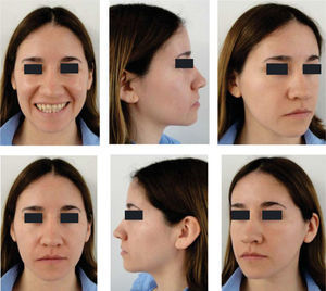 Initial facial photographs.