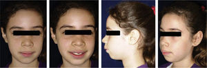 Fotografías extraorales para la evaluación clínica inicial.