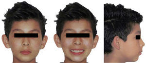 Fotografías iniciales extraorales.