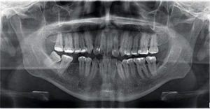 Initial panoramic radiograph.
