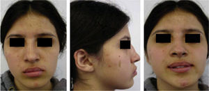 Facial photographs: frontal, right profile and smile.