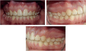 Final intraoral photographs.