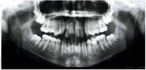 Initial panoramic radiograph.