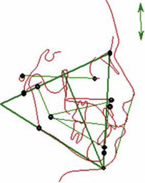Puntos de referencia, medidas angulares y lineales utilizadas para el análisis. Fuente: Directa.