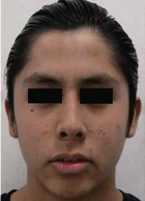 Fotografía extraoral inicial de frente.