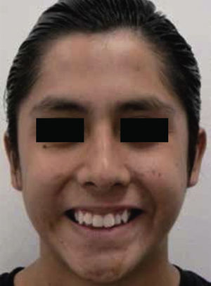 Foto sonrisa.
